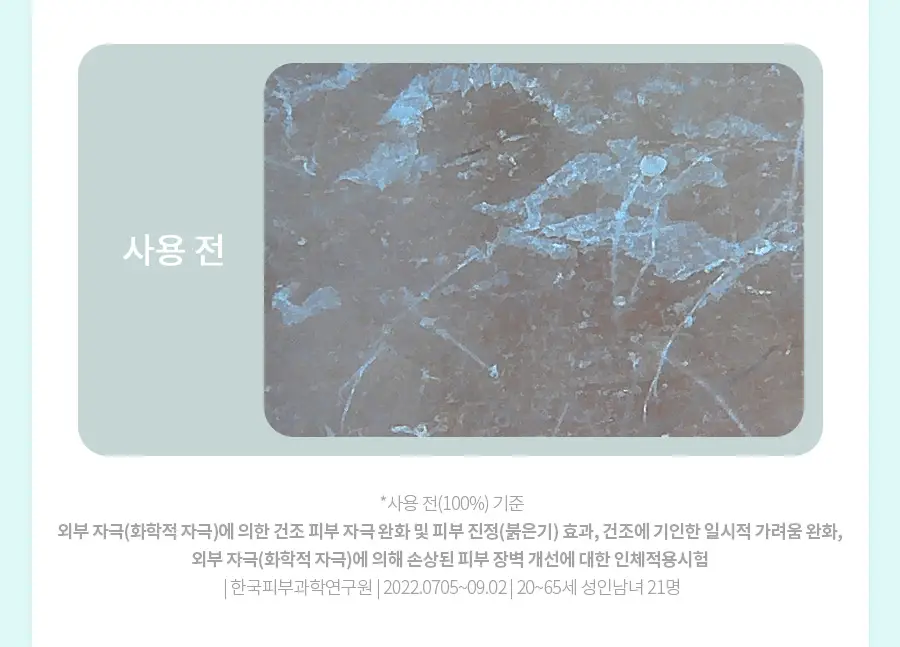 [속건조/진정보습] 닥터지 레드 블레미쉬 클리어 모이스처 크림 70ml 기획 (+30ml 증정) 상세페이지 21
